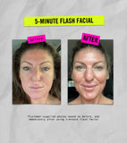 5-Min Flash Facial